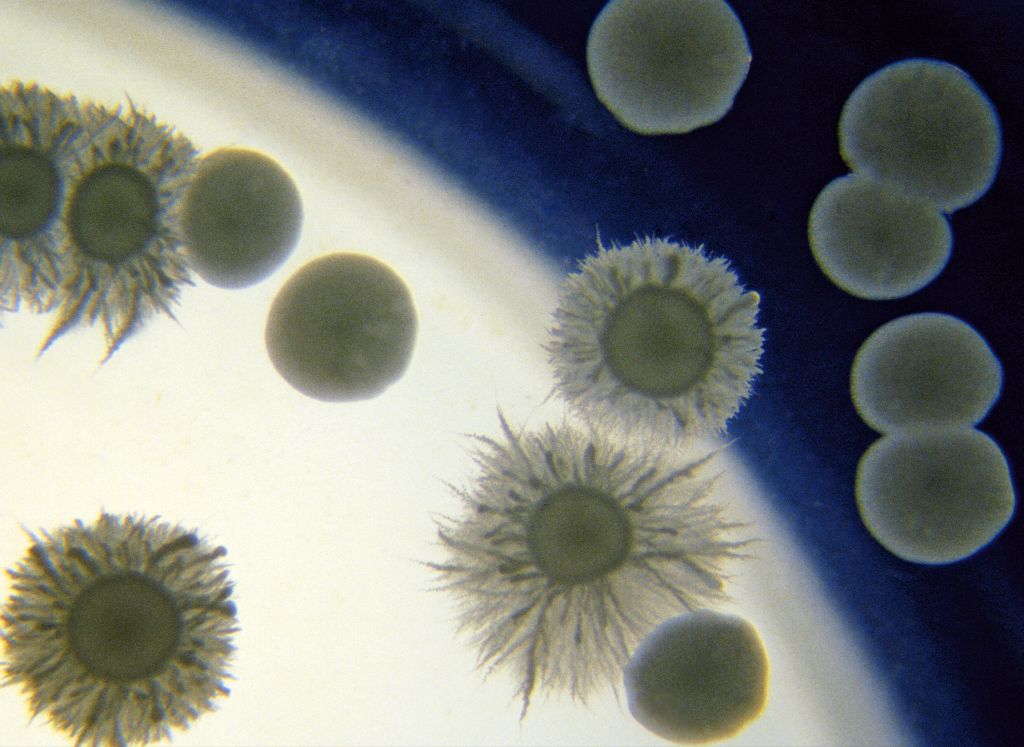 Growing two kinds of yeast colonies in the same Petri dish was a way to more clearly show their morphological differences. Felice Frankel